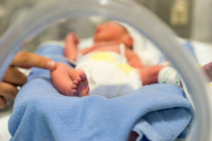 A newborn with hypoxic ischemic encephalopathy (HIE) being treated in a cooling blanket.