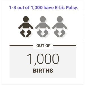 1-3 out of every 1,000 babies are born with Erb's palsy