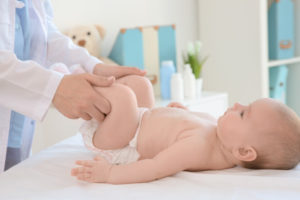 A doctor checks an infant for hip dysplasia and other birth injuries by bending their legs at the knees.