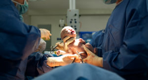 Doctors examine a newborn in the delivery room to determine the baby's Apgar score.
