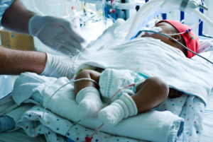 A newborn with breathing tubes and IVs receives care in a hospital crib at a neonatal intensive care unit.