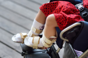 girl with cerebral palsy and leg braces in a wheelchair