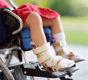 A child sitting in a wheelchair wearing orthotic leg braces for cerebral palsy.