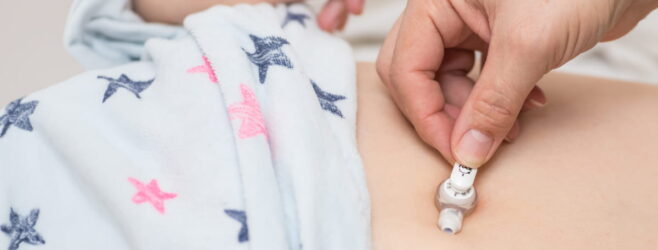 Caregiver adjusts feeding tube port