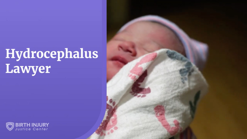 Hydrocephalus Lawyer Video Thumbnail