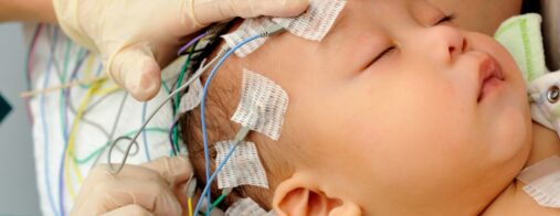 A health care provider applies probes to a baby's head for neuroimaging