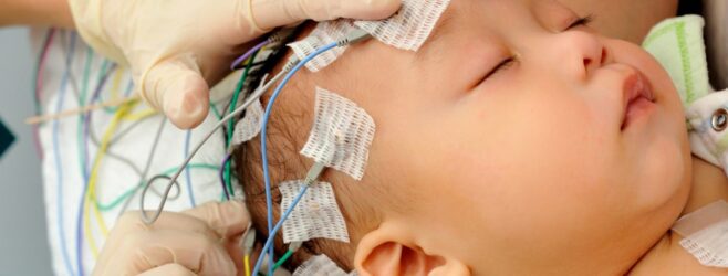 A health care provider applies probes to a baby's head for neuroimaging