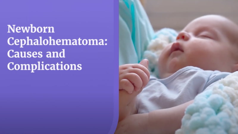 Newborn Cephalohematoma Video Thumbnail