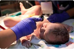 A medical professional shines a light in the eye of a newborn on a delivery room bed to check for birth injury.